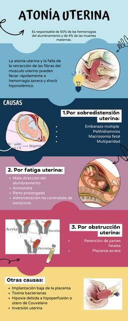 Esquema sobre la fisiopatología de la atonía uterina como causa principal de hemorragia posparto.