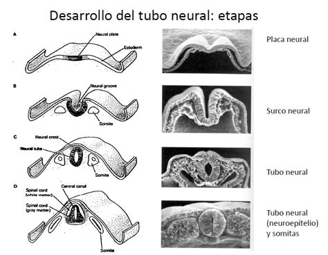 Diagrama del tubo neural en desarrollo, mostrando el punto crítico de cierre y las posibles malformaciones.
