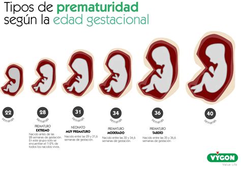 infografía sobre las tres categorías de prematuridad según la edad gestacional: extremos (antes de la 28), muy prematuros (28-32) y moderados/tardíos (32-37)
