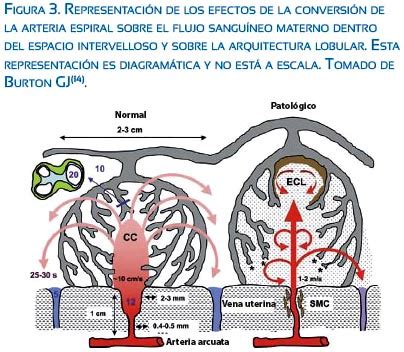 Diagrama de las arterias uterinas y espirales irrigando el lecho placentario