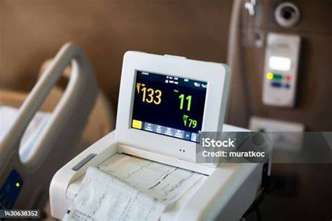 Equipo de cardiotocografía realizando una prueba sin estrés