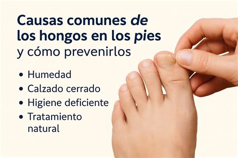 Infografía con consejos de prevención de hongos en los pies de niños