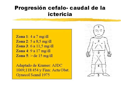 Diagrama de la progresión cefalocaudal de la ictericia