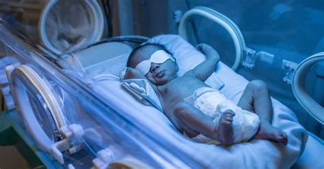 Recién nacido bajo lámpara de fototerapia en incubadora