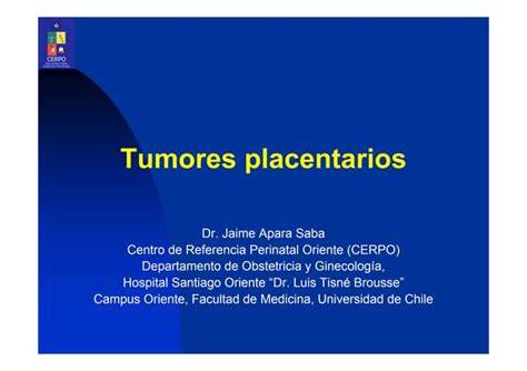 Ilustración de los diferentes tipos de tumores placentarios y su ubicación