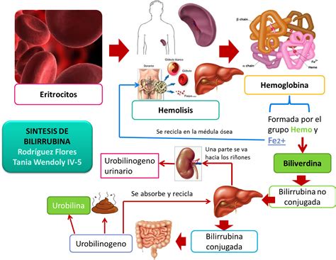 Esquema de la fisiopatología: obstrucción del flujo biliar, acumulación de bilirrubina conjugada y sus efectos tóxicos en el hepatocito