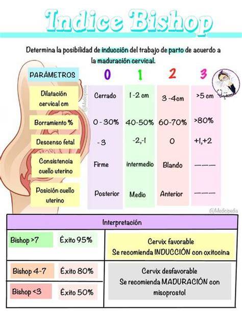 Esquema ilustrativo del índice de Bishop comparando un cuello uterino inmaduro frente a uno maduro y favorable para el parto.