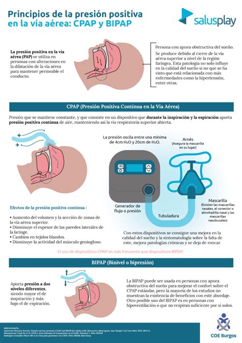 Infografía sobre el funcionamiento de la CPAP en neonatos