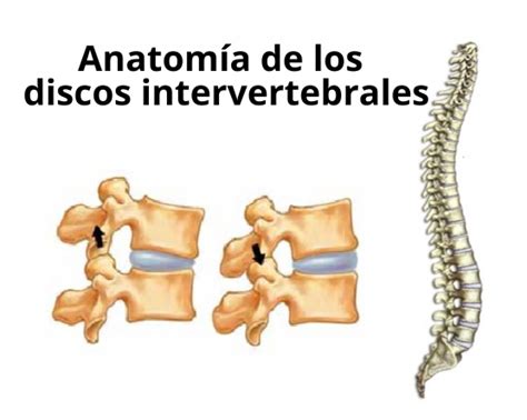 Ilustración anatómica de la columna vertebral con énfasis en los discos intervertebrales