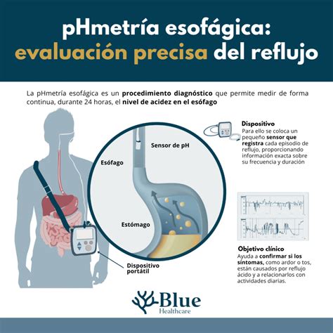 Infografía: Procedimiento de pHmetría e impedanciometría pediátrica