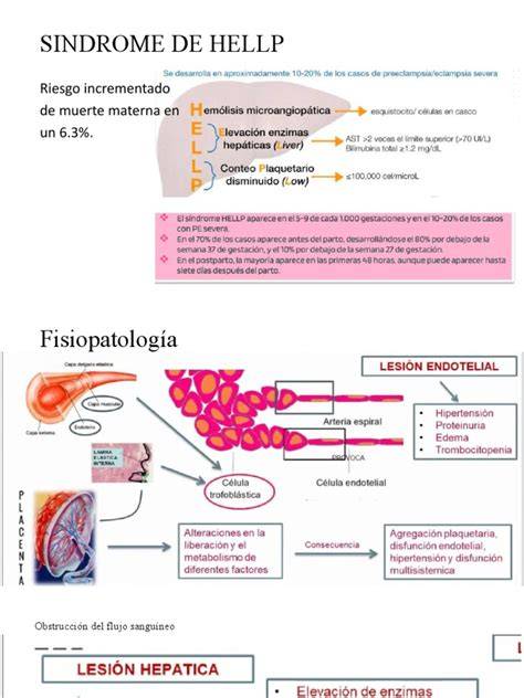 Infografía sobre los criterios diagnósticos y la fisiopatología del Síndrome HELLP