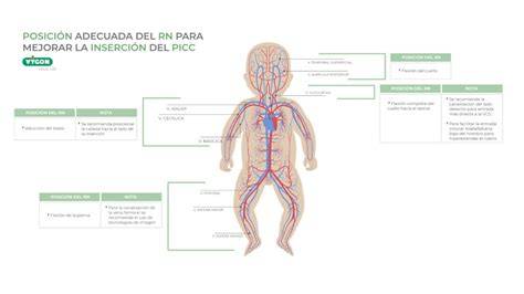 Esquema de las venas adecuadas para PICC en un neonato
