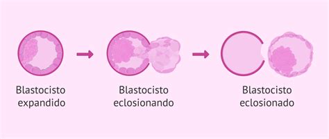 Esquema del proceso de eclosión de una tortuga, mostrando la carúncula y el saco vitelino.