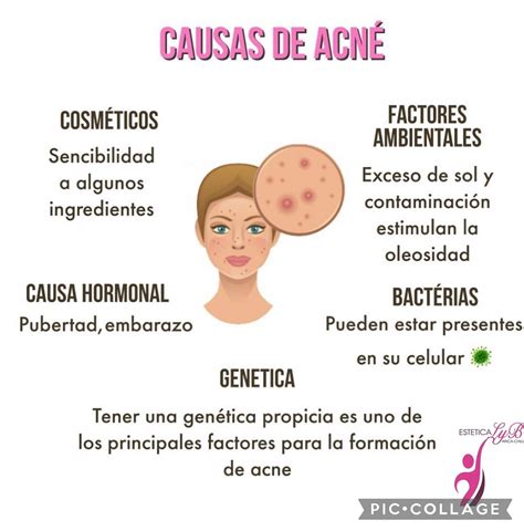 infografía sobre las causas del acné postparto, incluyendo factores hormonales, estrés y dieta
