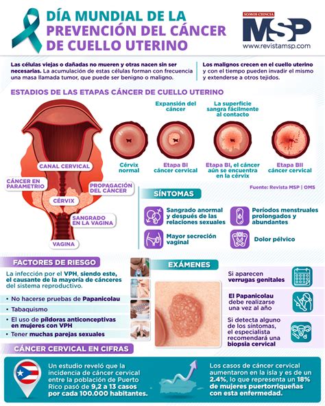Infografía sobre la preparación del cuello uterino antes de un aborto quirúrgico