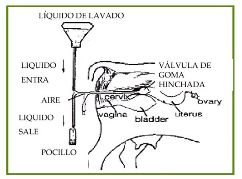 Esquema detallado del procedimiento de lavado uterino para la recolección de embriones bovinos.