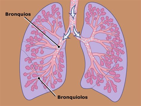 Ilustración del sistema respiratorio infantil, destacando los bronquiolos y alvéolos, para explicar la bronquiolitis y la neumonía.