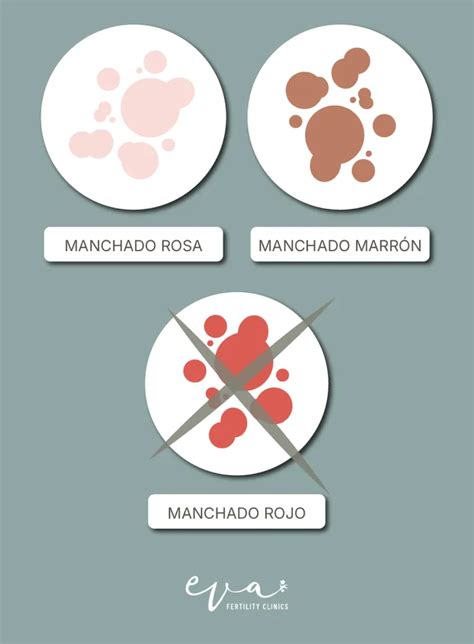 Infografía comparativa que muestra la diferencia visual entre el manchado leve en la ropa interior y un sangrado abundante similar a la menstruación