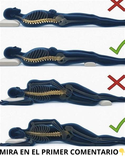 Esquema anatómico mostrando la alineación neutra de la columna vertebral al dormir de lado con almohada entre las rodillas.
