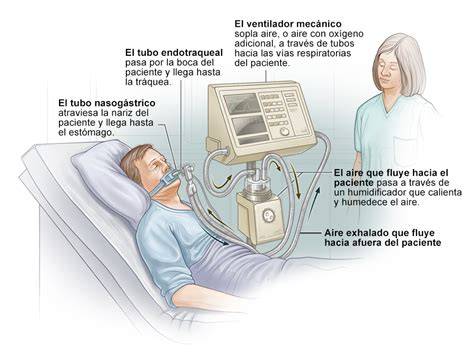 Esquema de un niño con soporte ventilatorio en UCIP
