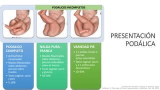 Tipos de presentación podálica (franca, completa, de pie)