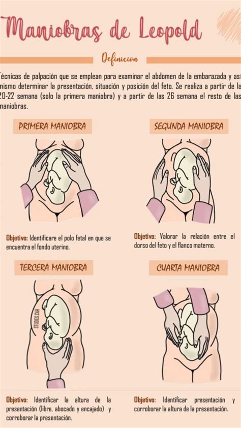 Representación de las Maniobras de Leopold para la palpación fetal