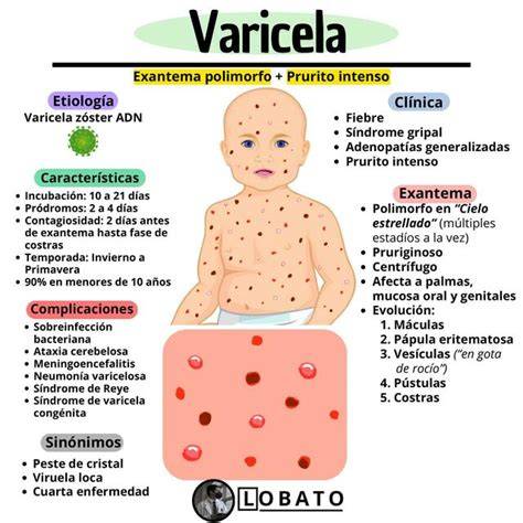 Esquema que muestra la evolución clínica de la varicela, desde el periodo de incubación hasta la formación de costras.