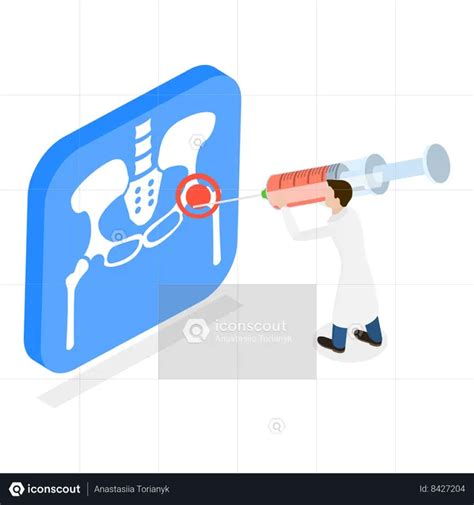 Ilustración de una jeringa inyectando cortisona en una articulación