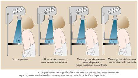 Esquema: Técnica de compresión mamaria durante el uso del sacaleches para asegurar el vaciado completo del pecho.