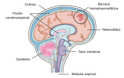Esquema anatómico que muestra la inflamación de las meninges y la barrera hematoencefálica en un recién nacido