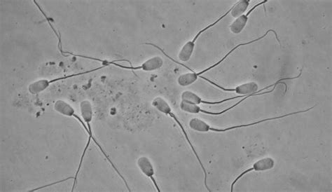 Espermatozoides bajo el microscopio