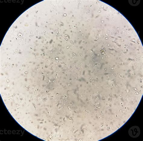 Análisis de semen bajo el microscopio
