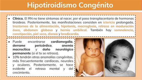 Esquema de las causas de hipotiroidismo congénito (disgenesia, dishormogénesis, etc.)