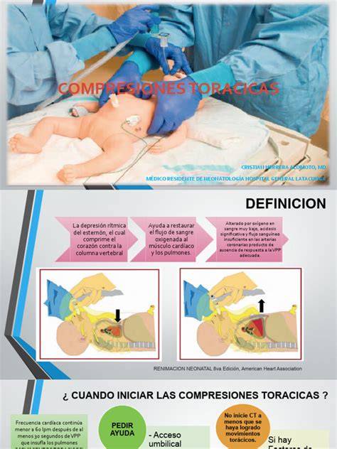 Esquema de las compresiones torácicas en un neonato durante la reanimación