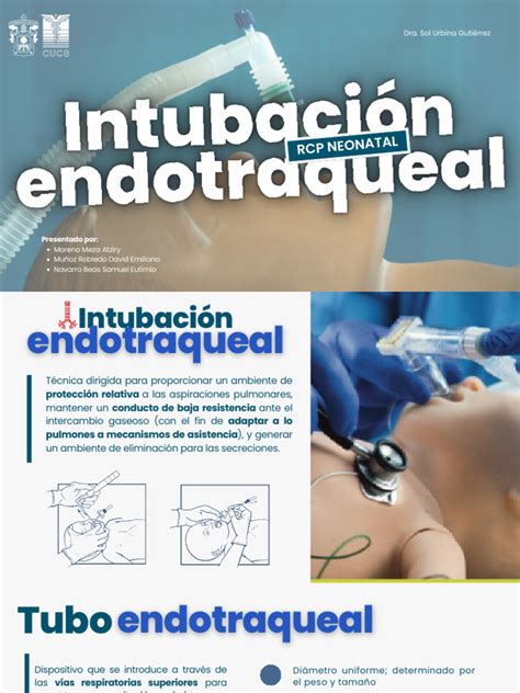 Esquema de intubación endotraqueal neonatal con guía