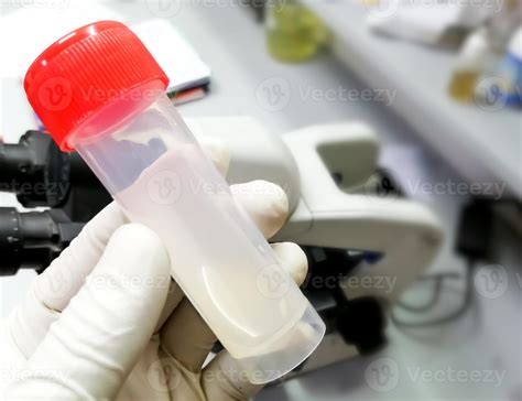 Material de laboratorio para análisis de semen