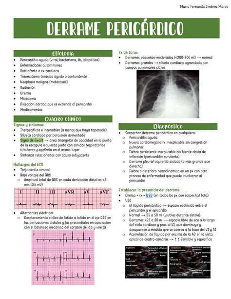 Ecocardiograma de un lactante con derrame pericárdico severo y colapso de cámaras cardíacas derechas