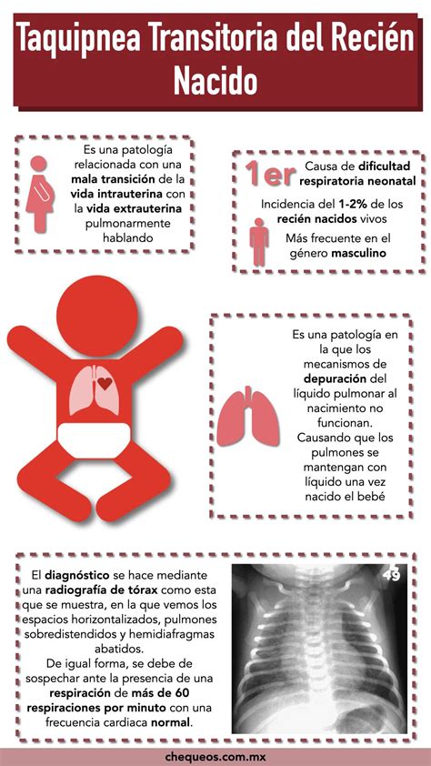 Infografía: Factores de riesgo para taquipnea transitoria del recién nacido