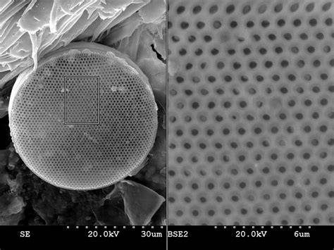 Microscopía electrónica de barrido de un ovocito humano no fecundado mostrando la red porosa y la superficie compacta de la zona pelúcida