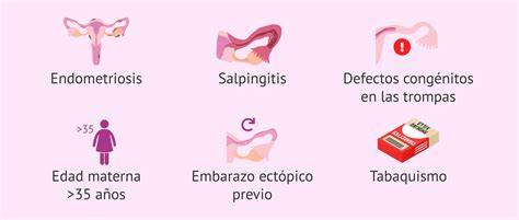 Esquema anatómico que ilustra la diferencia entre un embarazo intrauterino normal y las posibles localizaciones de un embarazo ectópico: trompas, ovarios, cérvix y abdomen.