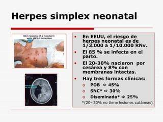 Esquema de las formas clínicas de herpes neonatal
