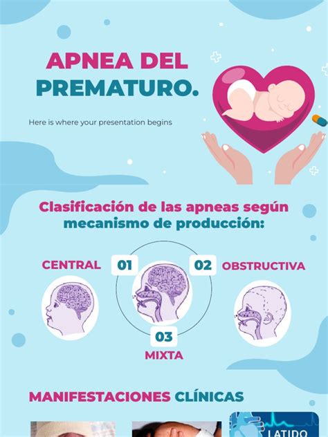 Gráfico de barras mostrando la incidencia de apnea del prematuro en relación con la edad gestacional