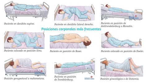 Secuencia de imágenes mostrando la posición del lactante y la técnica de estimulación vesical y lumbar para la recogida de orina