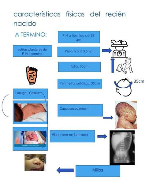 Infografía detallando las características físicas típicas de un recién nacido, incluyendo la forma de la cabeza, proporción del cuerpo, y características de la piel.
