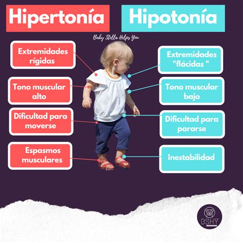 Diagrama esquemático del tono muscular en recién nacidos, mostrando la diferencia entre hipotonía e hipertonía.