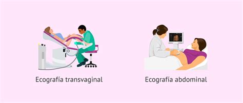 Ilustración: Tipos de diagnóstico ecográfico en ovejas (vía transabdominal y transrectal)