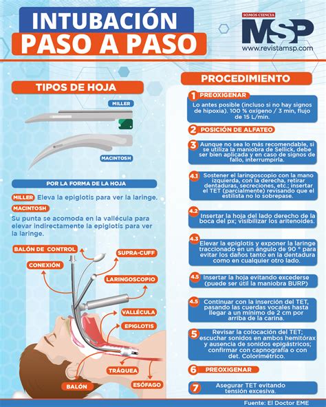 Esquema de intubación endotraqueal en neonato con monitorización