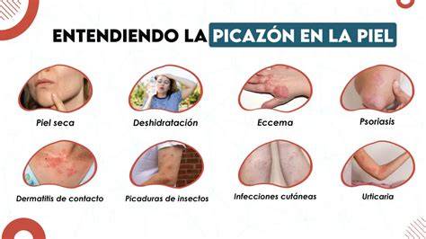 Infografía: Causas comunes de la picazón en la cicatriz de cesárea (regeneración nerviosa, piel seca, estiramiento)