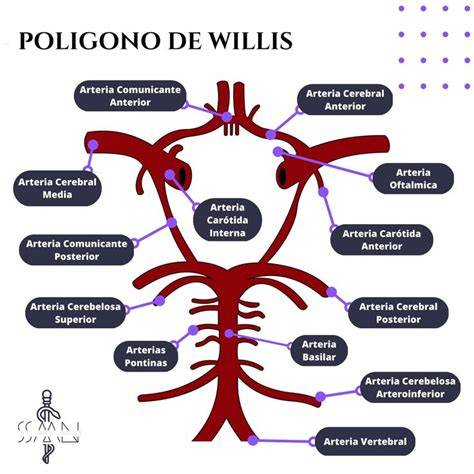 Infografía mostrando los diferentes segmentos del Polígono de Willis y las ubicaciones más comunes de hipoplasia y aneurismas.