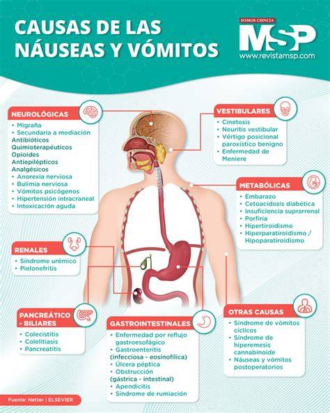 Esquema de las causas de vómitos en recién nacidos por grupos de edad